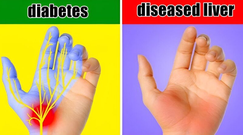 Hands Reflect our Health – Here’s What Your Hands Can Reveal About Your Health