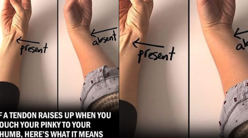 If a Tendon Raises Up When You Touch Your Pinky to Your Thumb, Here’s What It Could Mean