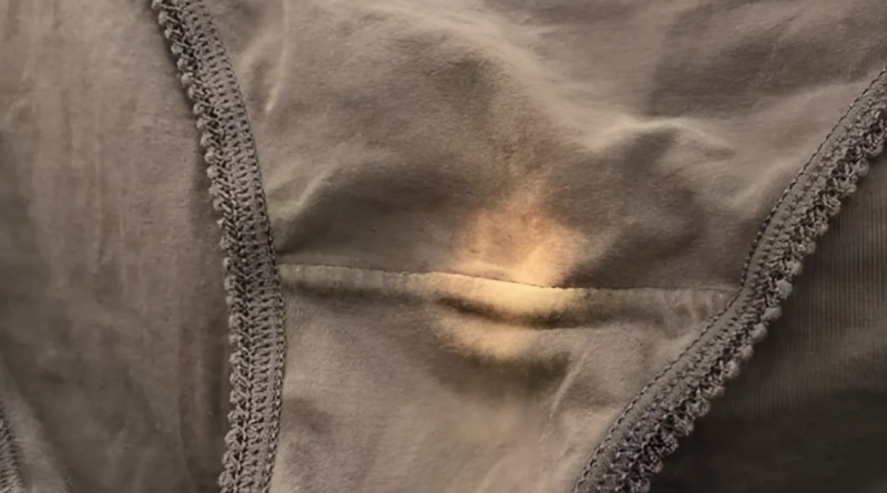 The Mystery of Bleach Spots on Underwear Solved