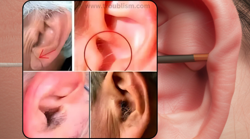 Did you know that if your ear hairs grow, it is because your body is